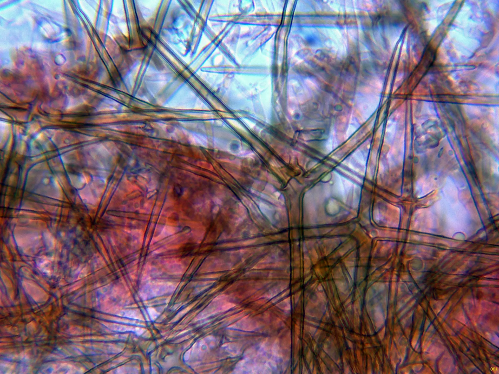10 - Asterosetas-001